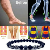 Anti-Swelling Black Obsidian Anklet Bracelet Treatment  Adjustable Weight Loss Magnetic Therapy Magnet Anklet Bracelet Women Men