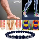 2022 Treatment of Varicose Veins Obsidian Anklet Adjustable Weight Loss Magnetic Therapy Magnet Anklet Bracelet for Mom Dad